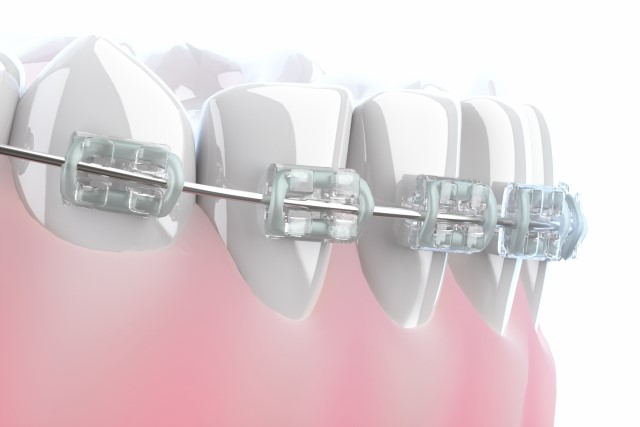 矯正歯科とは