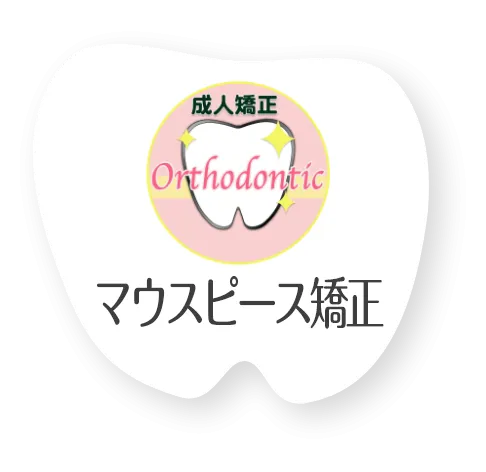 マウスピース矯正