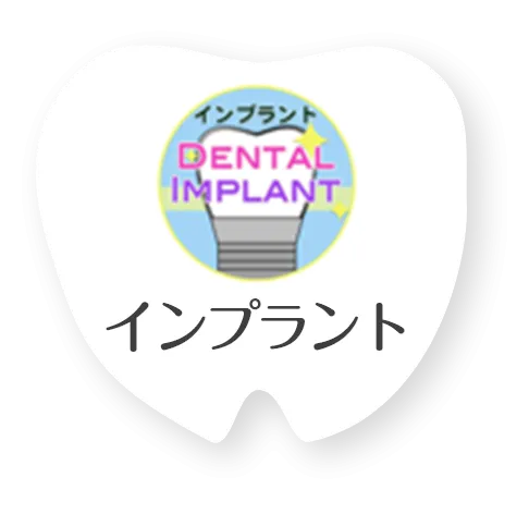 インプラント